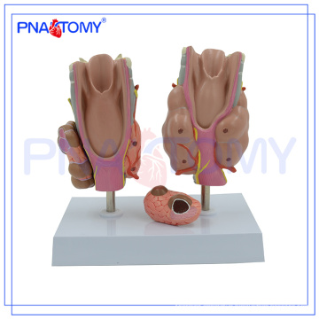 PNT-0757 Thyroid disease model,Thyroid model,Thyroid anatomy model